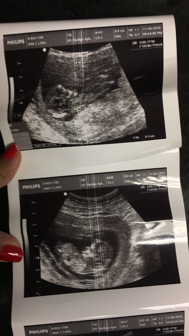 6AB5C30F-990A-4BBF-A9A4-1A28415AA90A