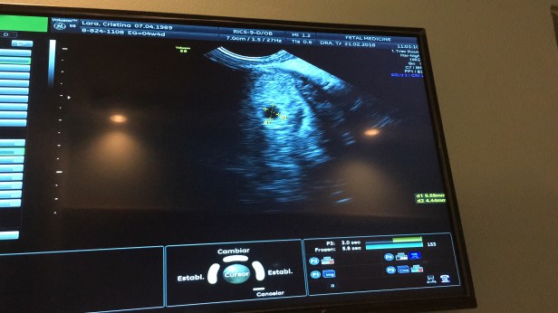 98C66CF8-B76C-4C42-BE64-EA54B029161A